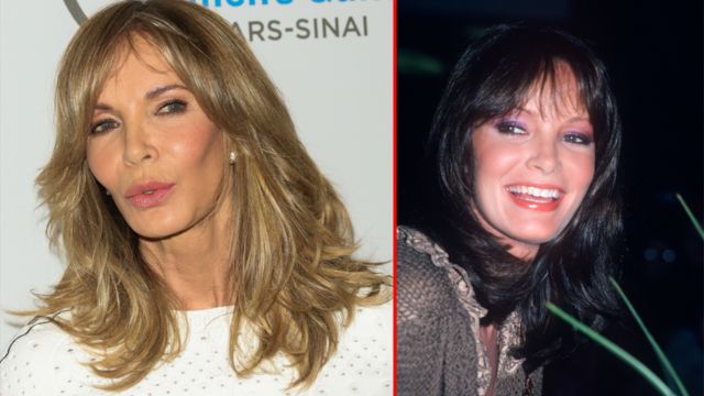Did Jaclyn Smith Get Plastic Surgery