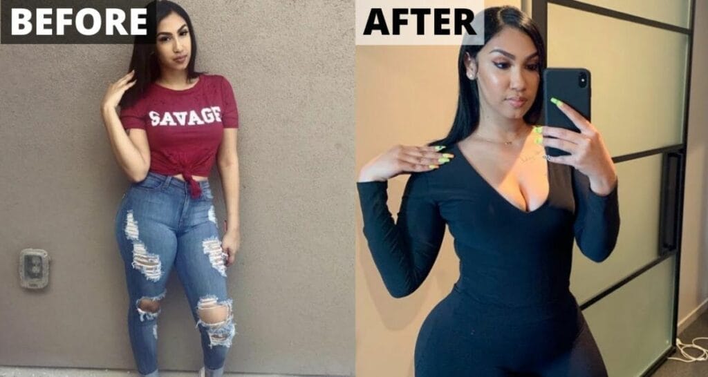 Queen Naija Before Surgery: Why is Twitter Talking About the Singer’s ...