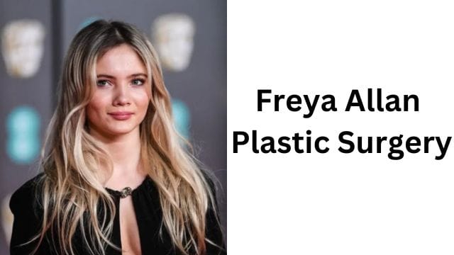 Freya Allan Plastic Surgery